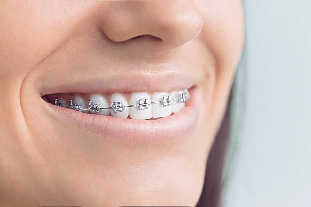 Why Choose Us for Your Dental Needs in Douglas, WY